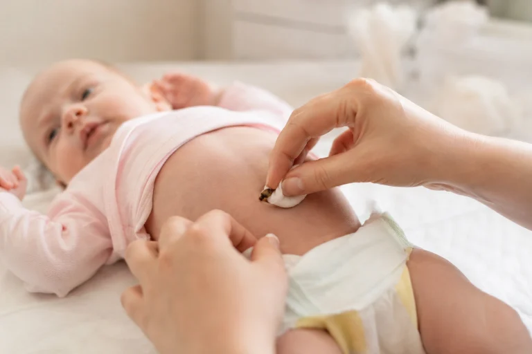 Nega Pupčanika kod Bebe: Sve što Mlada Mama Treba da Zna u Prvim Danima